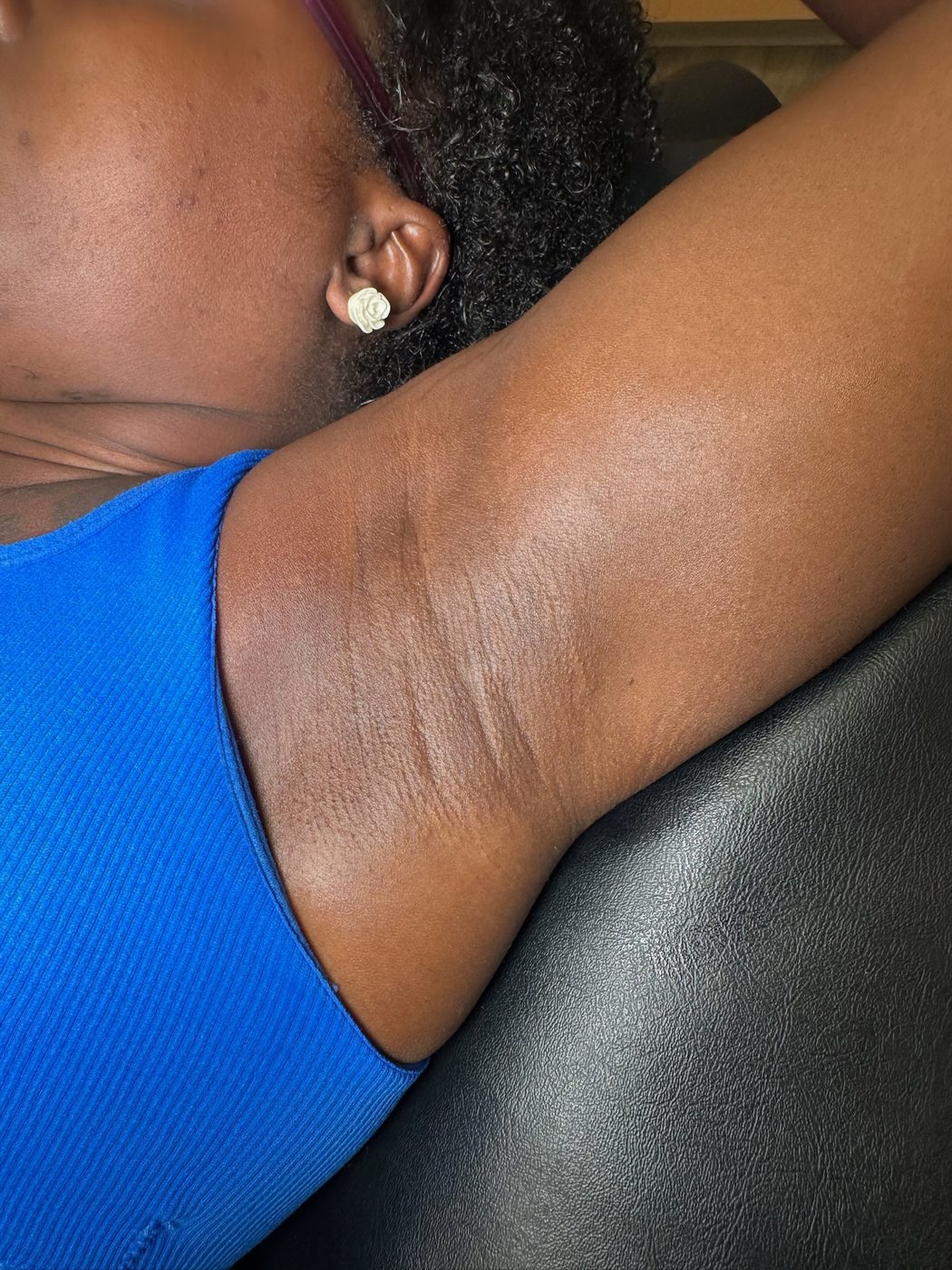 Underarm wax results